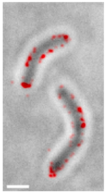 Single‐molecule tracking and super‐resolution imaging shed light on cholera toxin transcription activation